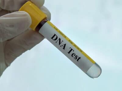dna testi