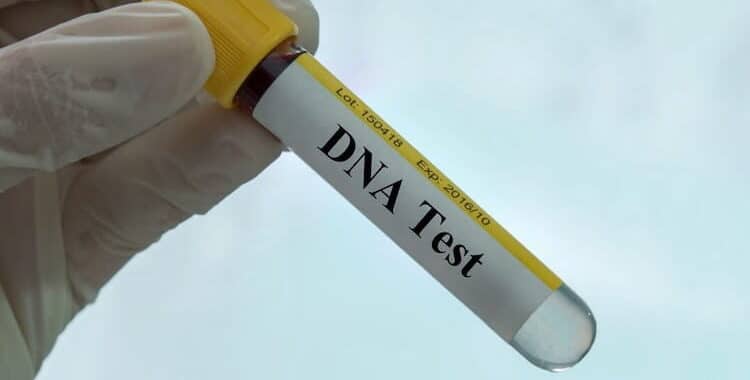 dna testi